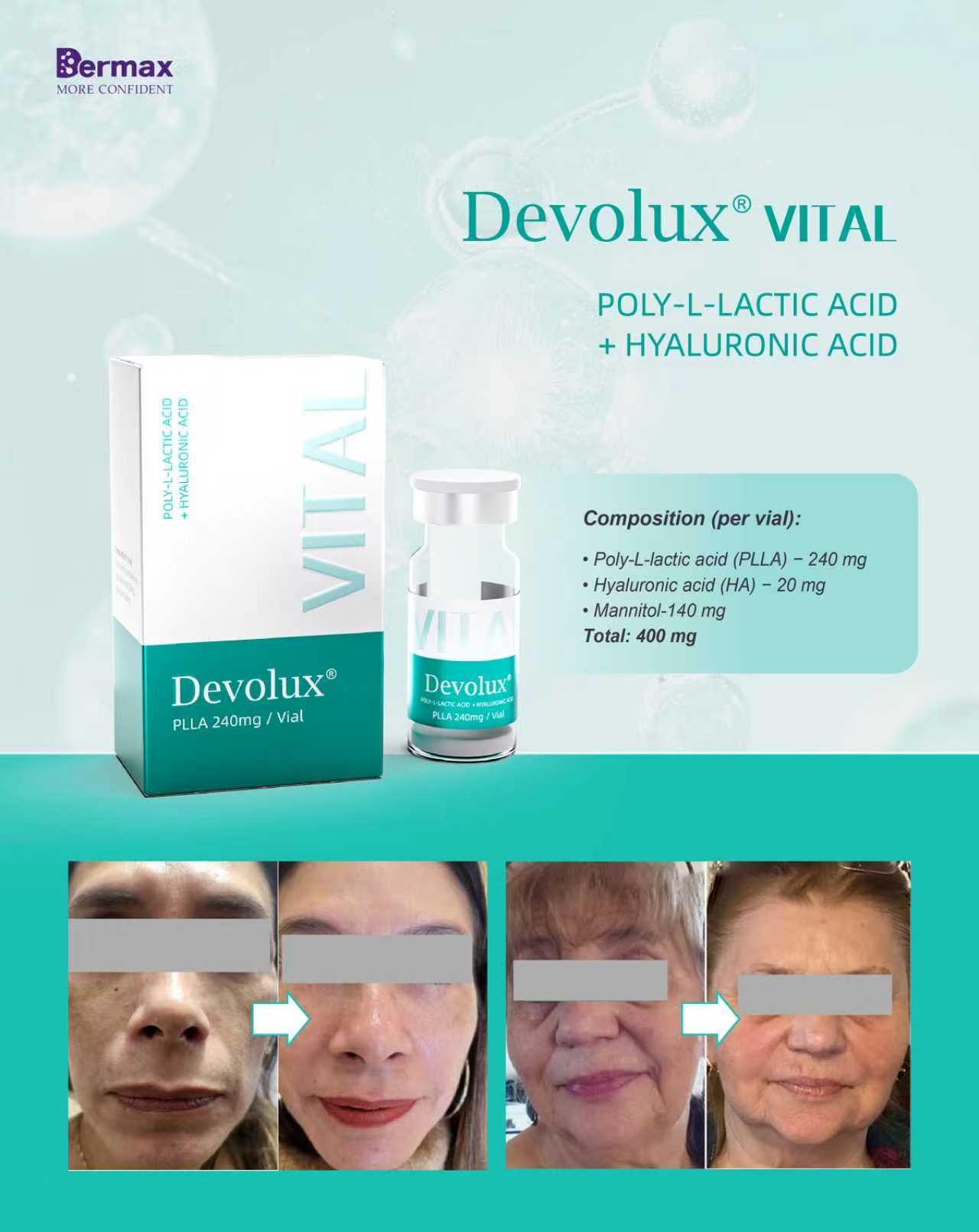Devolux&reg; Vital