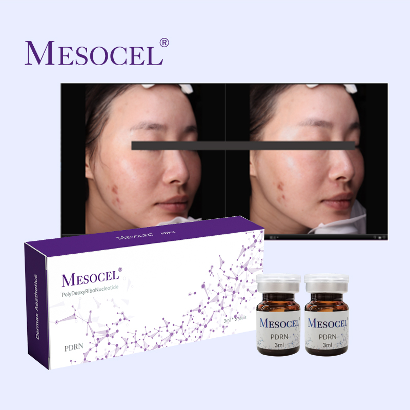 Mesocel PDRN Hyaluronic Acid Serum