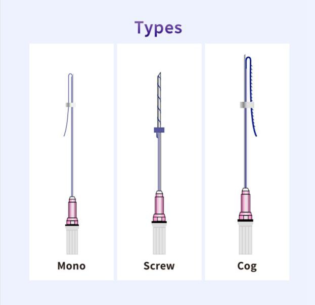 What is a cog thread (1)