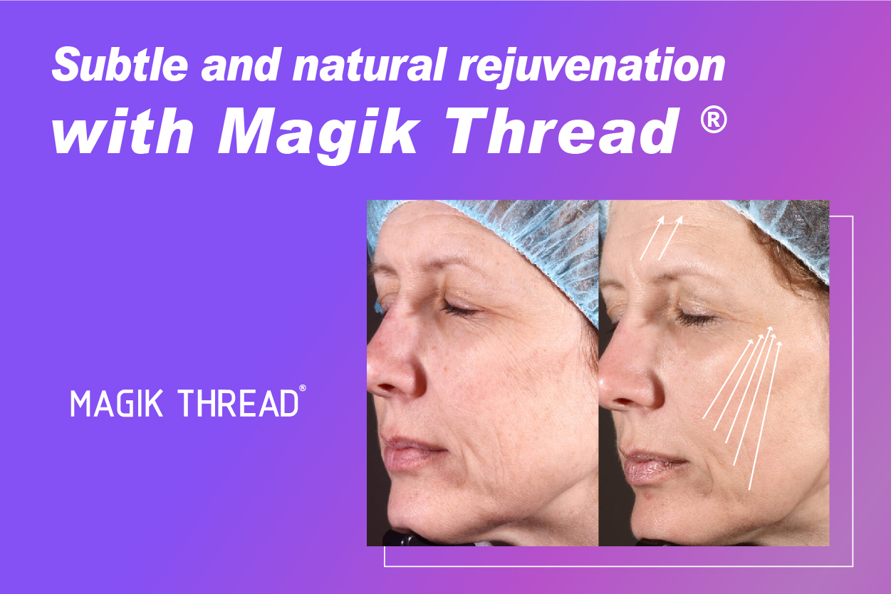 Why do doctors choose pdo mono thread (3)