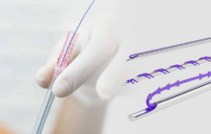 Pdo Thread Lift Korea Manufacturers