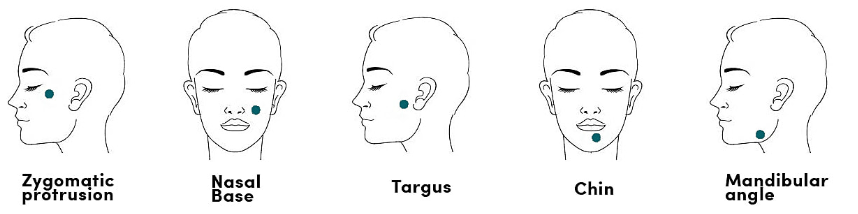 Prejuva Bio Remodelling Treatment Cost