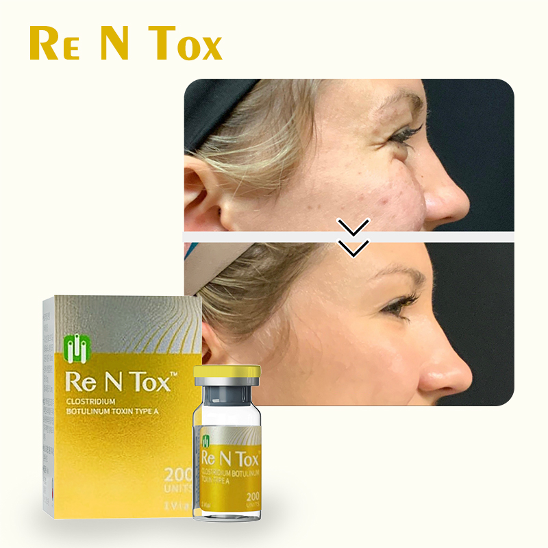 Botulinum Toxin Rentox 100 Units Injectables