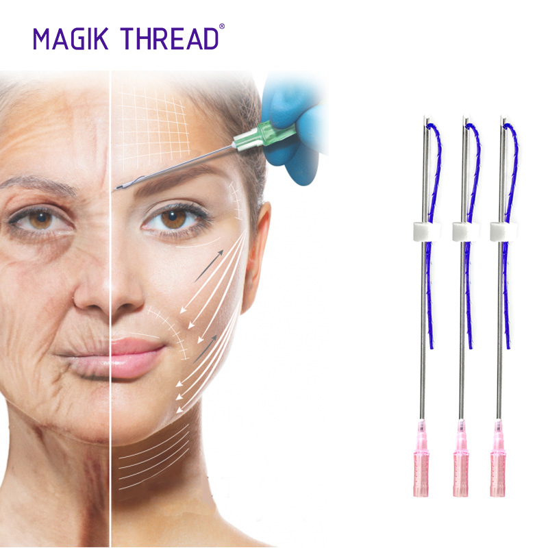 PDO Thread Placement: Achieving A Youthful Look Without Surgery