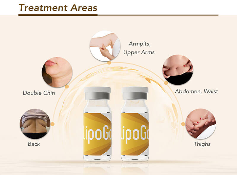 Treatment Areas LipoGo™ Lipolytic Solution