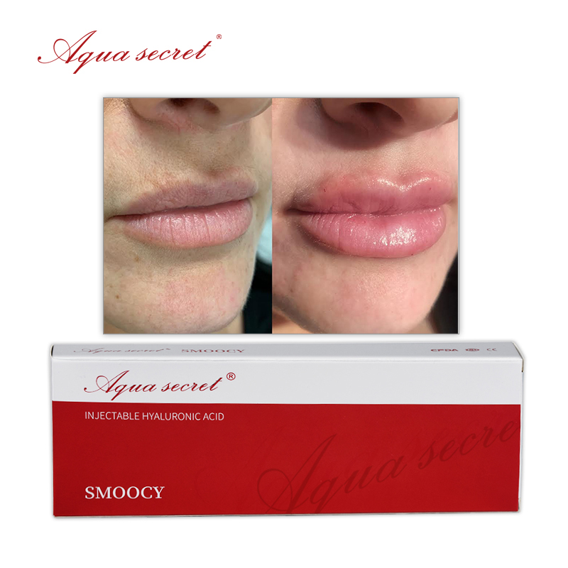 1ml lip filler before and after.jpg