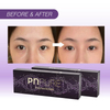 Polynucleotide Under-Eye Solution — Clinician Supply & Protocols