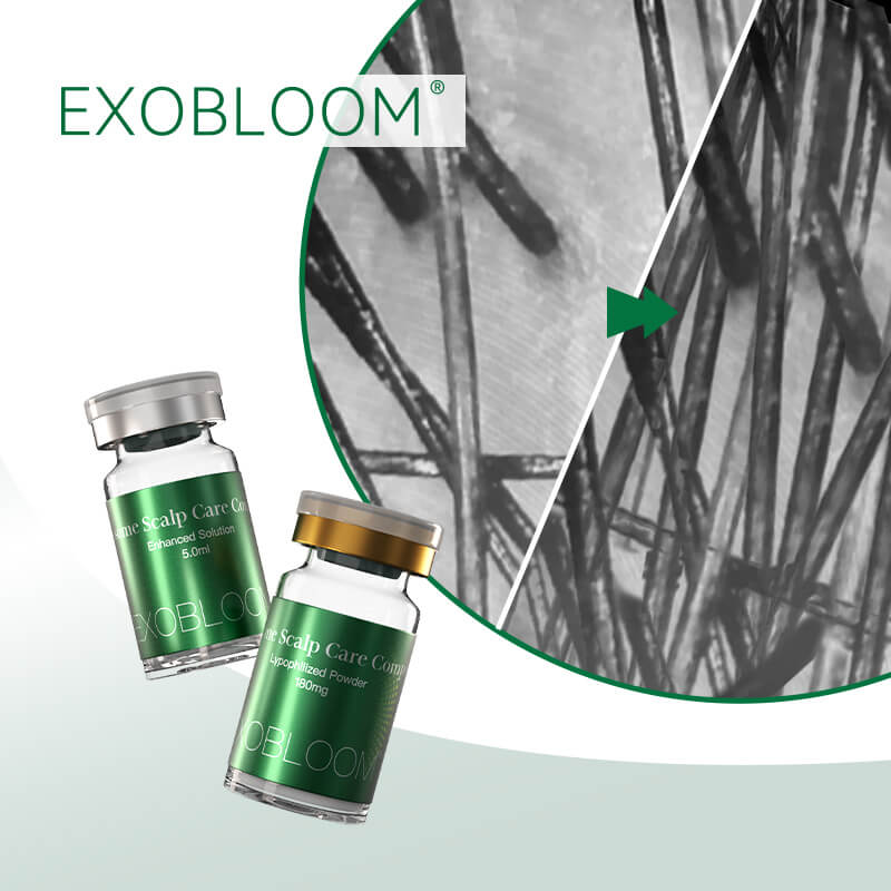EXOBLOOM&reg; Scalp Care
