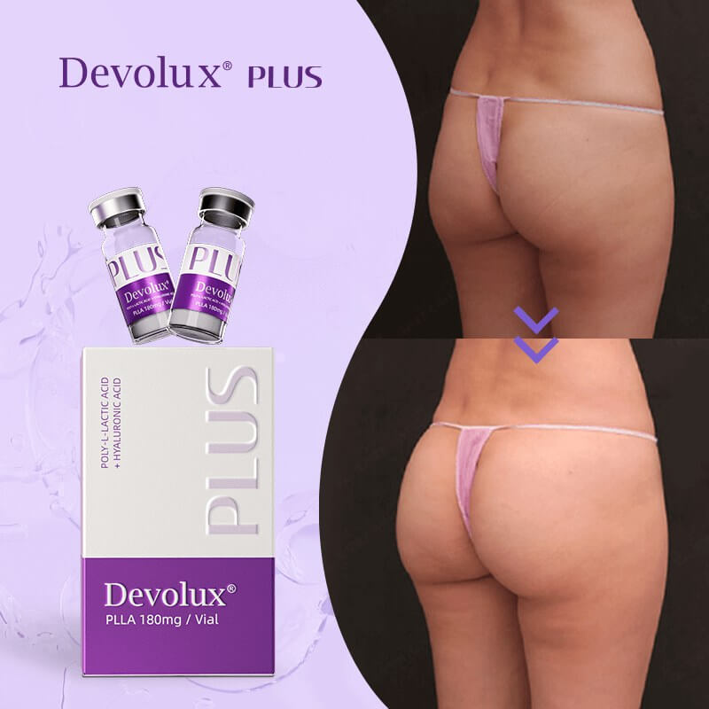 plla filler buttock injections