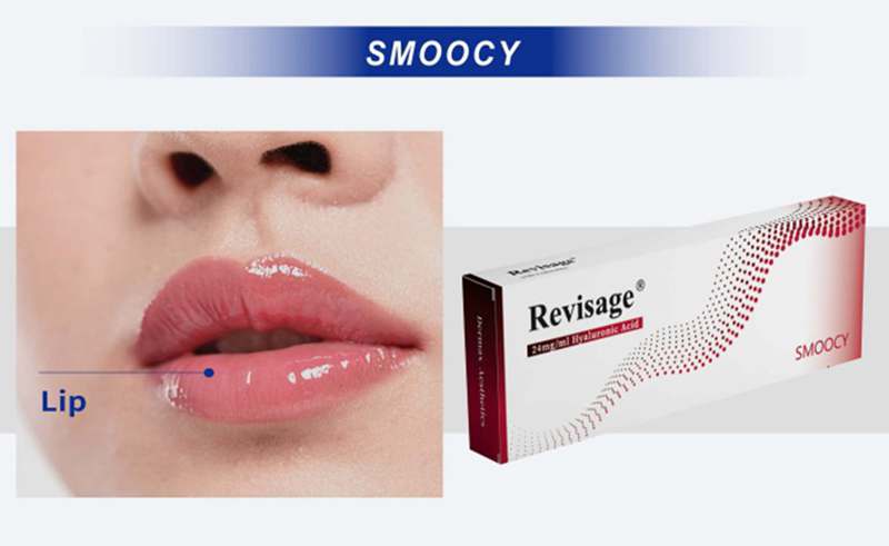 lip filler price los angeles