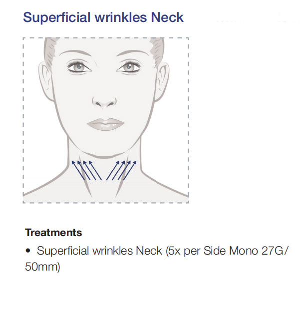 pdo smooth threads neck