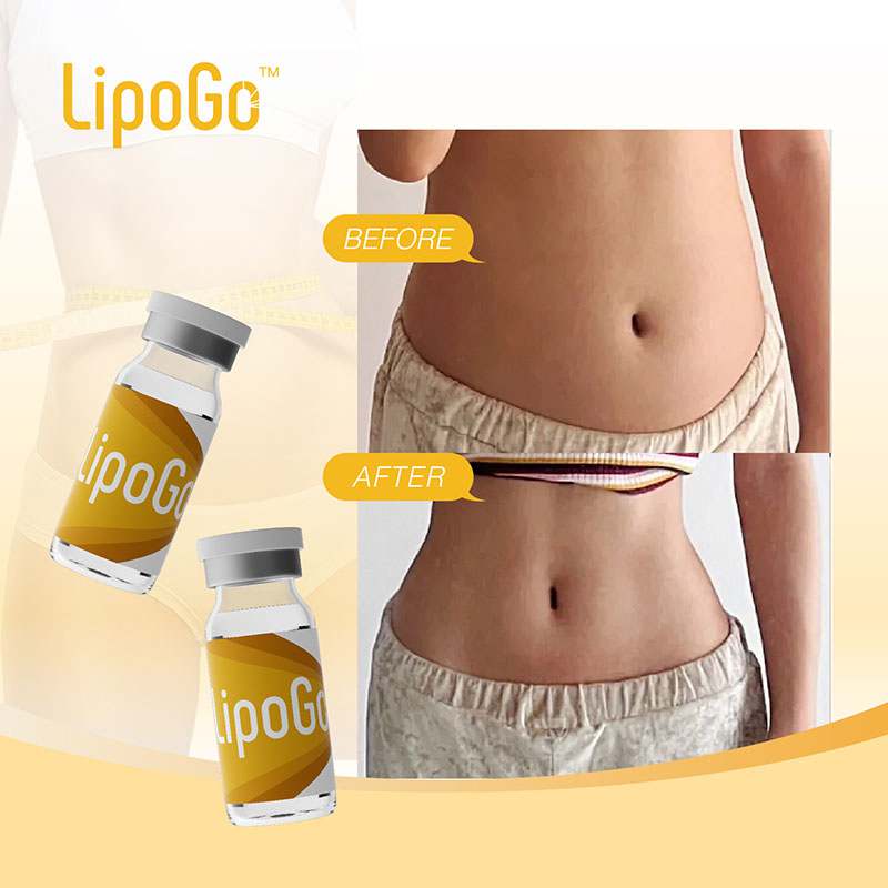 LipoGo Abdomen Fat Dissolving Injection