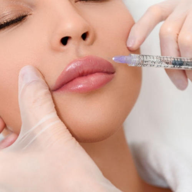 what is hyaluronic acid lip filler