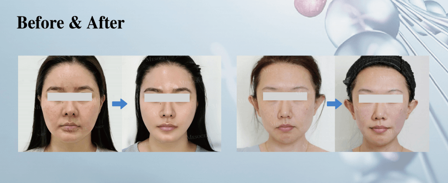 Mesocel&reg; NAD+ Renewal Booster