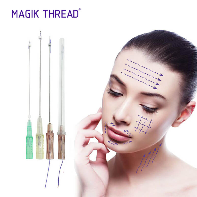 cannula pdo thread