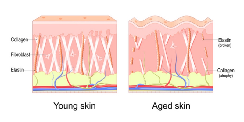 is calcium hydroxyapatite a stimulatory filler