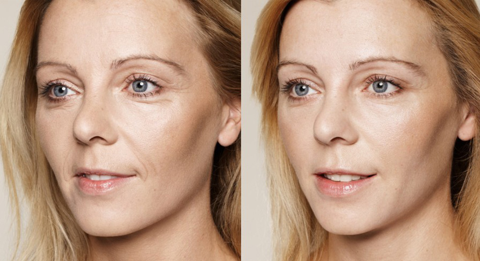 BEFORE-&-AFTER2